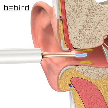 Bebird T15 Пречиствател за уши Minifit 2 в 1 Инструмент за отстраняване на восък от акне HD1080P Отоскоп IP67 Водоустойчив Ендоскоп Здравеопазване